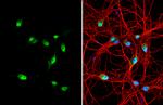 Centaurin alpha-1 Antibody in Immunocytochemistry (ICC/IF)