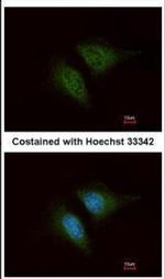 Coronin 3 Antibody in Immunocytochemistry (ICC/IF)