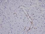 Coronin 3 Antibody in Immunohistochemistry (Paraffin) (IHC (P))