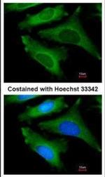 IL1RA Antibody in Immunocytochemistry (ICC/IF)