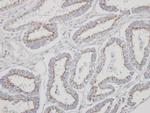 YIPF4 Antibody in Immunohistochemistry (Paraffin) (IHC (P))