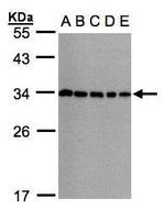 CHMP5 Antibody in Western Blot (WB)