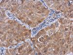 Actin-like 8 Antibody in Immunohistochemistry (Paraffin) (IHC (P))