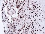 PSME3 Antibody in Immunohistochemistry (Paraffin) (IHC (P))