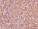 ACMSD Antibody in Immunohistochemistry (Paraffin) (IHC (P))