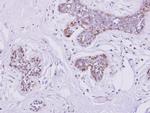 SLC25A33 Antibody in Immunohistochemistry (Paraffin) (IHC (P))