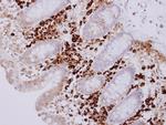 MZB1 Antibody in Immunohistochemistry (Paraffin) (IHC (P))