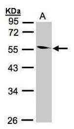 Coronin 1B Antibody in Western Blot (WB)