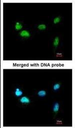 SCMH1 Antibody in Immunocytochemistry (ICC/IF)