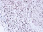 SCMH1 Antibody in Immunohistochemistry (Paraffin) (IHC (P))