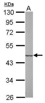 SUCLG2 Antibody in Western Blot (WB)