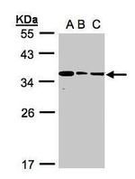 Bisphosphoglycerate mutase Antibody in Western Blot (WB)