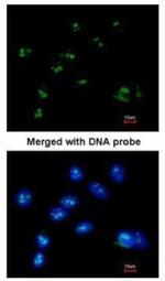 RASSF2 Antibody in Immunocytochemistry (ICC/IF)