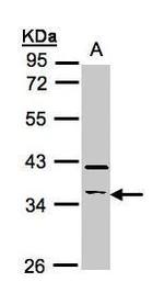 RASSF2 Antibody in Western Blot (WB)