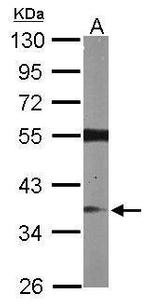 RASSF2 Antibody in Western Blot (WB)