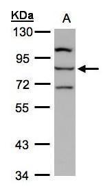 ALOXE3 Antibody in Western Blot (WB)