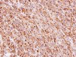 TTC30A Antibody in Immunohistochemistry (Paraffin) (IHC (P))