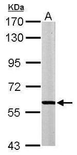 MPP2 Antibody in Western Blot (WB)