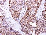 DCK Antibody in Immunohistochemistry (Paraffin) (IHC (P))