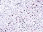 DRAK1 Antibody in Immunohistochemistry (Paraffin) (IHC (P))