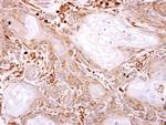 VPS11 Antibody in Immunohistochemistry (Paraffin) (IHC (P))