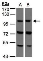 VPS11 Antibody in Western Blot (WB)