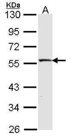 MST4 Antibody in Western Blot (WB)