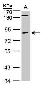 LIMK2 Antibody in Western Blot (WB)