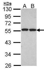 ETEA Antibody in Western Blot (WB)