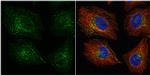 VPS35 Antibody in Immunocytochemistry (ICC/IF)