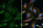 VPS35 Antibody in Immunocytochemistry (ICC/IF)