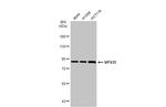 VPS35 Antibody in Western Blot (WB)