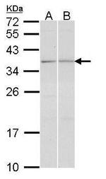 TGIF2 Antibody in Western Blot (WB)