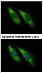 Munc13-4 Antibody in Immunocytochemistry (ICC/IF)