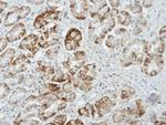 Munc13-4 Antibody in Immunohistochemistry (Paraffin) (IHC (P))