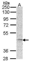 MC5R Antibody in Western Blot (WB)