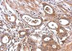 MC1R Antibody in Immunohistochemistry (Paraffin) (IHC (P))