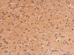 MC1R Antibody in Immunohistochemistry (Paraffin) (IHC (P))