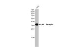 MC1R Antibody in Western Blot (WB)