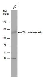 Thrombomodulin Antibody in Western Blot (WB)