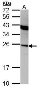 Interferon alpha-2 Antibody in Western Blot (WB)