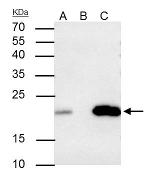 Caveolin 2 Antibody in Immunoprecipitation (IP)