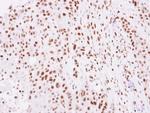 Histone H2A.Z Antibody in Immunohistochemistry (Paraffin) (IHC (P))