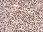 PFKFB3 Antibody in Immunohistochemistry (Paraffin) (IHC (P))