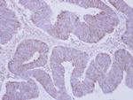 PHKA2 Antibody in Immunohistochemistry (Paraffin) (IHC (P))