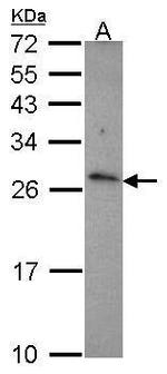 CD70 Antibody in Western Blot (WB)