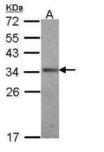 IL24 Antibody in Western Blot (WB)