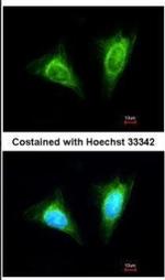 NKG2A Antibody in Immunocytochemistry (ICC/IF)