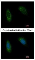 TRAM1 Antibody in Immunocytochemistry (ICC/IF)