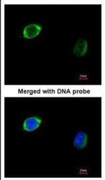 RAB2B Antibody in Immunocytochemistry (ICC/IF)